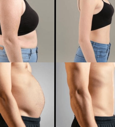 weight loss before and after